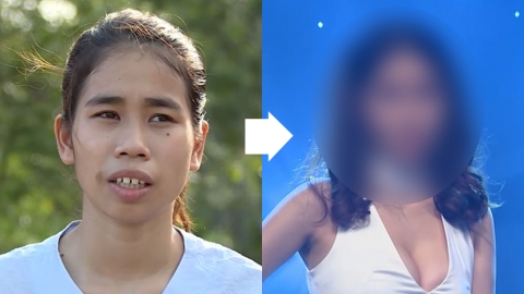 越南女因貌醜求職屢遭拒 整容變美女 聾啞母拒認：這不是我女兒